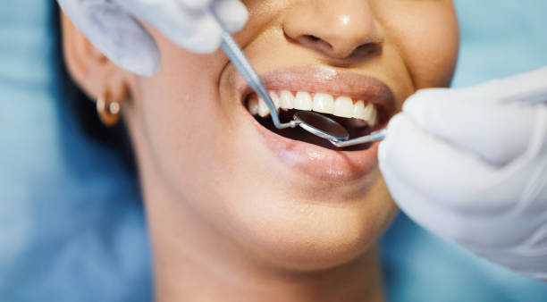 Best Chipped Tooth Repair Near Me  in Monticello, FL